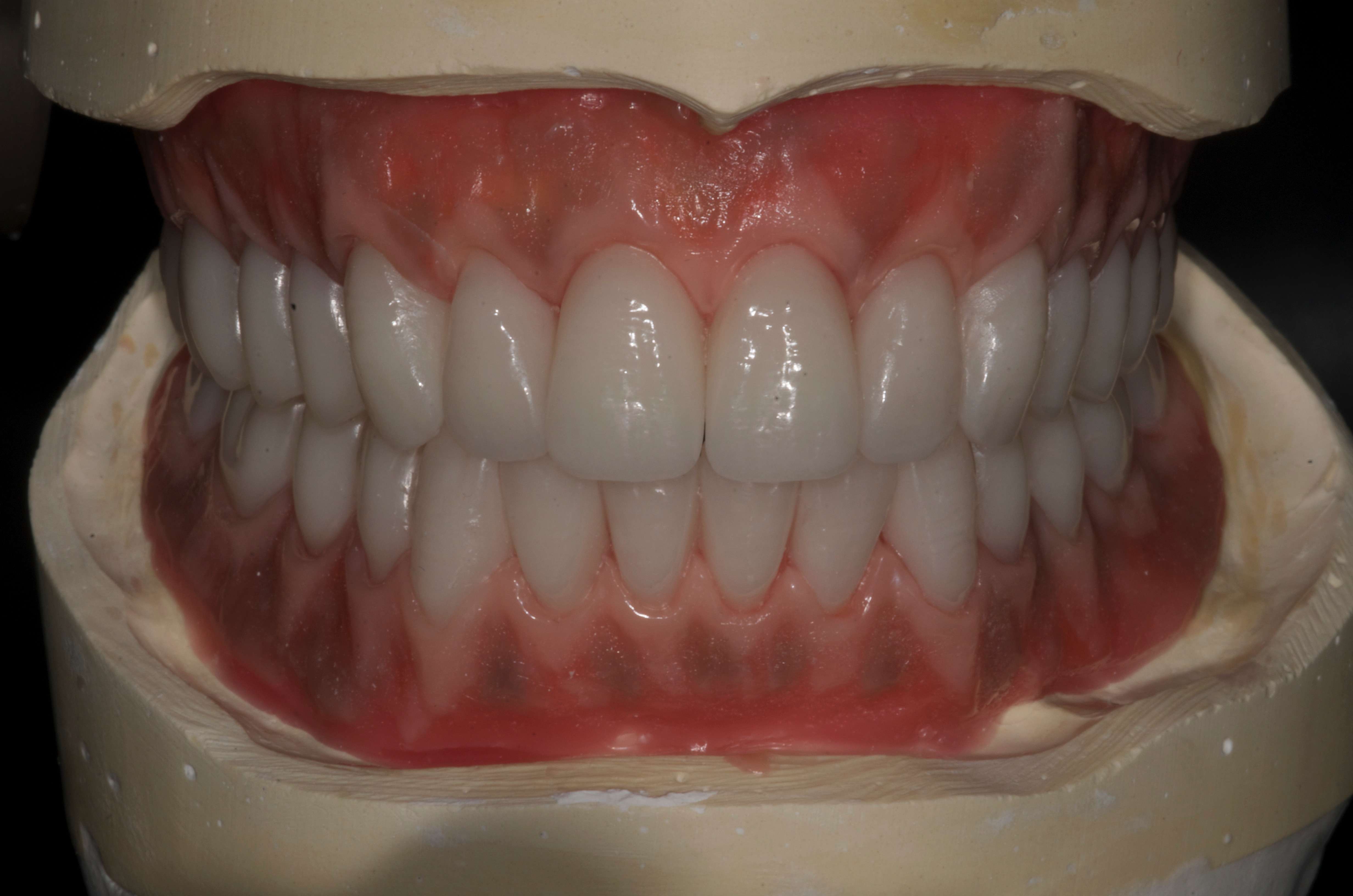 Case of the Month Archive Gordana Dental Art Studio